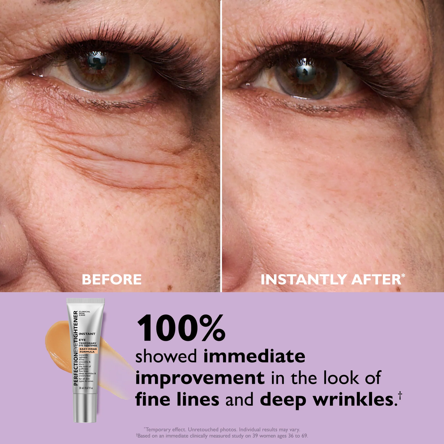 Instant Eye Tightener, Firm and Smooth the Look of Fine Lines